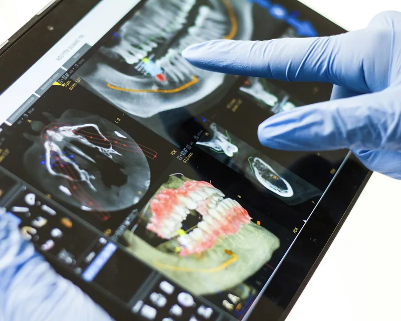 Gloved hand pointing at a 3D dental scan on a tablet screen